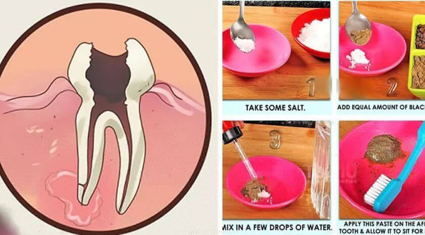 quick-homemade-remedy-for-toothache