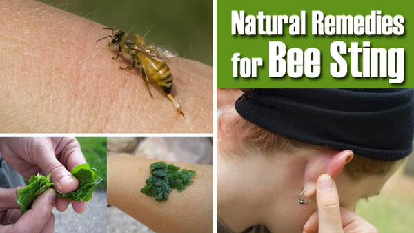 Home Remedies For Bee Stings