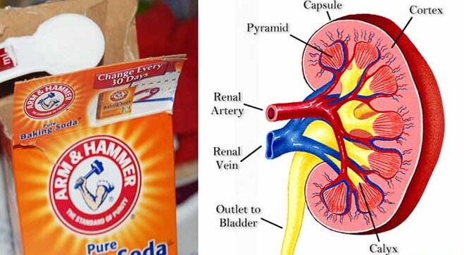 what-happens-to-your-kidneys-when-you-ingest-baking-soda-baking-soda