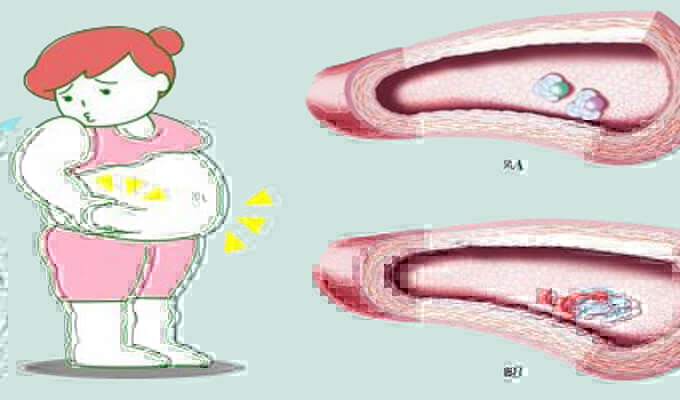EXPLAIN WHY METABOLIC SYNDROME IS SO DANGEROUS visual data 3
