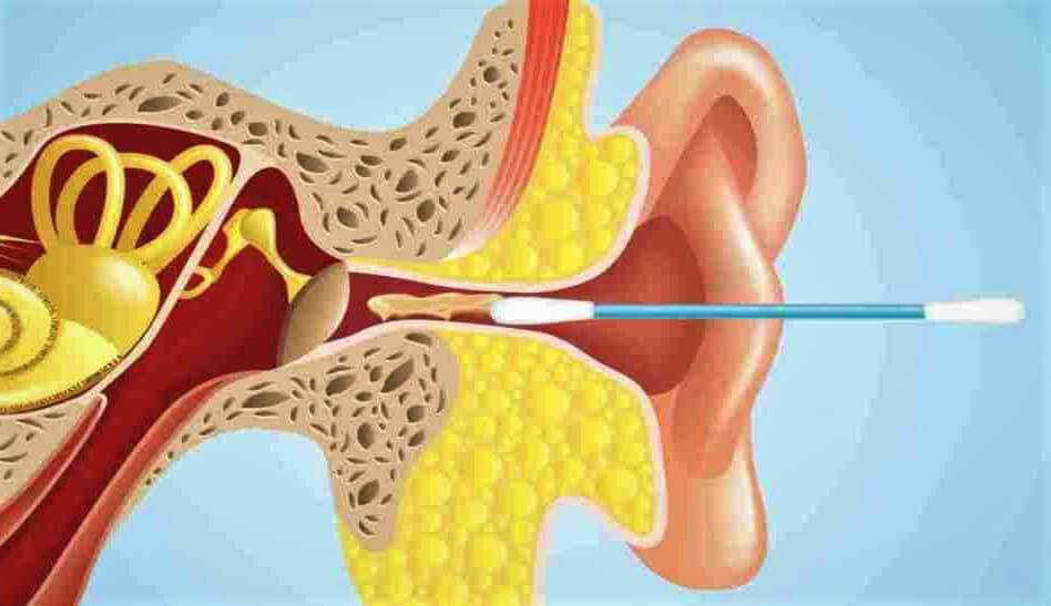 Researchers Are Explaining Why QTips Are Not Good To Use